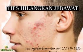 Masalah ini bisa sangat mengganggu jika tidak segera diatasi karena bisa menyebabkan kurangnya. Tips Hilangkan Jerawat Pengedar Shaklee Kuala Lipis