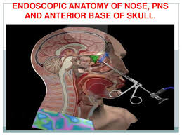 Human anatomical nasal cavity throat anatomy medical model teaching tool medical science stationery for school. Endoscopic Anatomy Of Nose And Pns