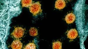 The covid variant now named delta, which was first detected in india, has been reported in 62 countries, the who said wednesday. Should Americans Worry About The Delta Coronavirus Variant Miami Herald
