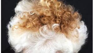 Ratselhaft Das Steckt Dahinter Wenn Graue Haare Die Farbe Wechseln Der Spiegel