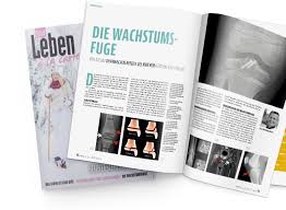 Morphofunktionelle studien an der wachstumsfuge nach xenotransplantation in die thymusaplastische na. Die Wachstumsfuge Leben A La Carte