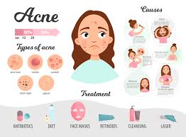 Pin On Face Products Skincare