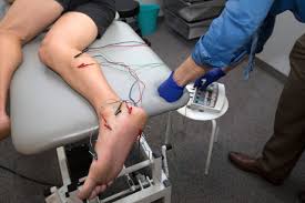 Image result for Electrical Stimulation Therapy