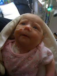 What this means is, so we have known. 4 Week Old B C Baby Diagnosed With Rare Form Of Leukemia