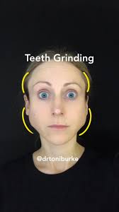 Spotting a Grinder, A lot of us clench (myself included and much of my  family). Amazingly, before I entered aesthetics, I just thought that square  jaws ran in our family. NO. We’re a bunch of ...