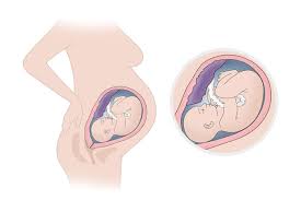 Schwangerschaftswoche bist du im 9. 33 Ssw Schwangerschaftswoche Geburtslage Netdoktor At
