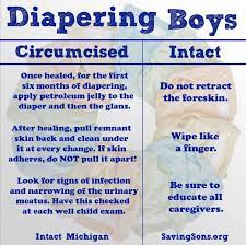 Dipering Boys Care For Circumcised And Intact Circumcision Care Newborn Circumcision Care Circumcision