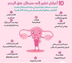 سرطان عنق الرحم هو نوع من السرطان يحدث Future Doctors Maroc Facebook
