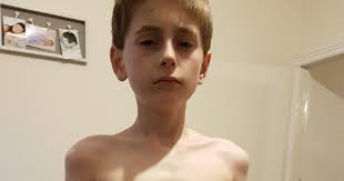 Sale boy rushed to hospital after sudden onset of diabetes