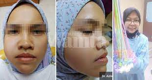 Atau kena tunggu tumbuh semua gigi kekal dulu ? Pakai Braces Lebih Tiga Tahun Sudahnya Bengkak Muka Gigi Rosak Teruk Mingguan Wanita