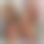 Image result for Skin Trauma