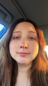 kidnokidney YOU GOT THIS HOMIE!! Well wishes for your little bean :) ...