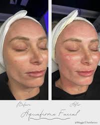 12 days of G L O W I N G✨✨