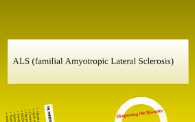 Als Familial Amyotropic Lateral Sclerosis By A M On Prezi