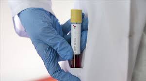 ماكرون يطالب بريطانيا بتحديد حليفها الأقرب. ÙƒÙˆØ±ÙˆÙ†Ø§ ØªØ³Ø¬ÙŠÙ„ Ø¥ØµØ§Ø¨Ø© Ø¬Ø¯ÙŠØ¯Ø© Ù„Ø·Ø§Ù„Ø¨Ø© ÙÙŠ Ø§Ù„Ø¥Ù…Ø§Ø±Ø§Øª