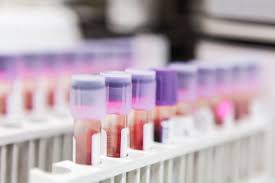 5 tumor marker for colon cancer and liver diseases. Breast Cancer Tumor Marker Tests