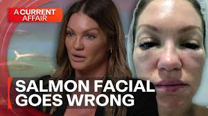 It's the latest beauty trend taking over, but one Aussie is warning you to  think twice. #9ACA