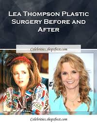 Lea Thompson Plastic Surgery Before And After Plastic Surgery Celebrity Surgery Surgery