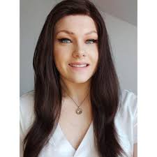 Living With Alopecia Kate-Leigh Speaks