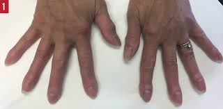 Image result for Digital Clubbing