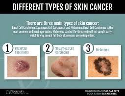 Basal cell, squamous cell, and. Why And How Skin Cancer Screening Can Save Your Life