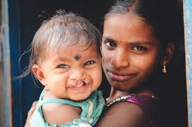 What Is a Cleft Lip and Palate?