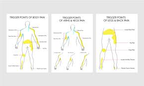 Four experts on myofascial pain syndrome (mfp) performed trigger point examinations and 4 active trigger points were found in about 18% of examinations of patients with fibromyalgia and mfp, but. Tender Points Fibromyalgia Vs Trigger Points Myofascial Pain Syndrome Nervous System Disorders And Diseases Articles Body Health Conditions Center Steadyhealth Com