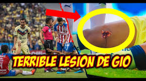 Una de las opciones que tiene el delantero mexicano estaría en fc juárez, equipo que lo dirige ricardo ferretti, quien en su momento habló maravillas del mexicano. Terrible Lesion De Giovani Dos Santos America Vs Chivas Pollo Briseno Entrada De Carcel Youtube