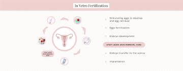 Especially for women worried about their fertility, the facts above dispel this myth. Can You Have Laser Hair Removal While Undergoing Ivf Urbana