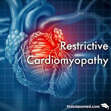Image result for Restrictive Cardiomyopathy