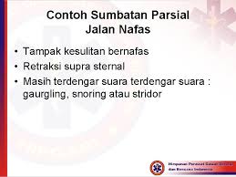 Check spelling or type a new query. Materi 1 Konsep Dan Asuhan Keperawatan Gawat Darurat