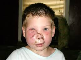 Ty Ty boy home after dog attack