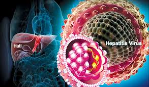 Hepatitis b merupakan sejenis penyakit yg berasal dari virus. Hcv Tiada Sebarang Vaksin