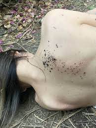 X