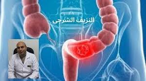 الفنان تاج الدين البمبي مابصدق دي النهاية. Ù‚Ù„Ø¨ÙŠ Ø¨Ù†Ø²Ù Ø¯Ù… Mp3