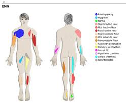 Interesting facts about voluntary muscles the human body has over 600 voluntary/skeletal muscles. Stalberg Software