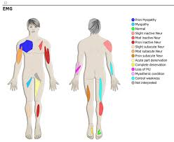 There is one deltoid muscle over each shoulder joint. Stalberg Software