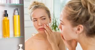 To extract the gel from the aloe vera plant, remove a large leaf of aloe from the bottom of the plant. Dermatologists On Reducing Inflammation And Redness On Face