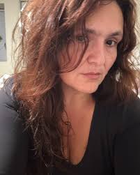 Thirteen-year-old Yann Gorbatov loves playing basketball, hanging out with  friends and testing the limits of his electric bicycle. A recent ride,  however, turned into a life-altering experience when he crashed. Yann came