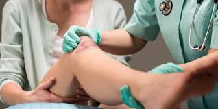 Prellung Behandlung Und Dauer Einer Prellung