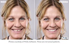 Feiler Dental Associates