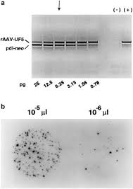 Image result for Gold 1997 AAV