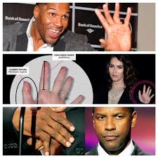 She got it stuck in the pulley of a well at her grandmother's house. Celebrities With Physical Imperfections That Don T Keep Them Out Of Movies Reelrundown