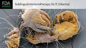 Image result for Dust mite