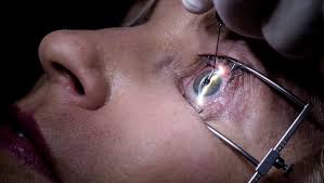 The vision care group of companies has built a reputation as one of the best eye care solution providers. New Help For That Bane Of Middle Age Blurry Close Up Vision