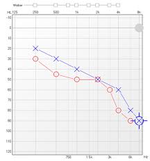 How Is An Audiogram Read Connect Hearing