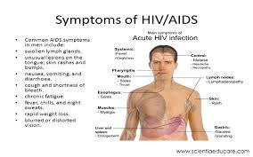 Pin On Symptoms Of Aids
