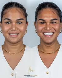 Marlen Cuero Perlaza (@odontologiamarlencuero) · Santiago de Cali