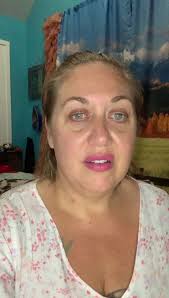 Managing Burning Mouth Syndrome with Dietary Changes and Specialist  Consultations