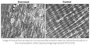 Training Mit Muskelkater Sinnvoll Trotzdem Trainieren